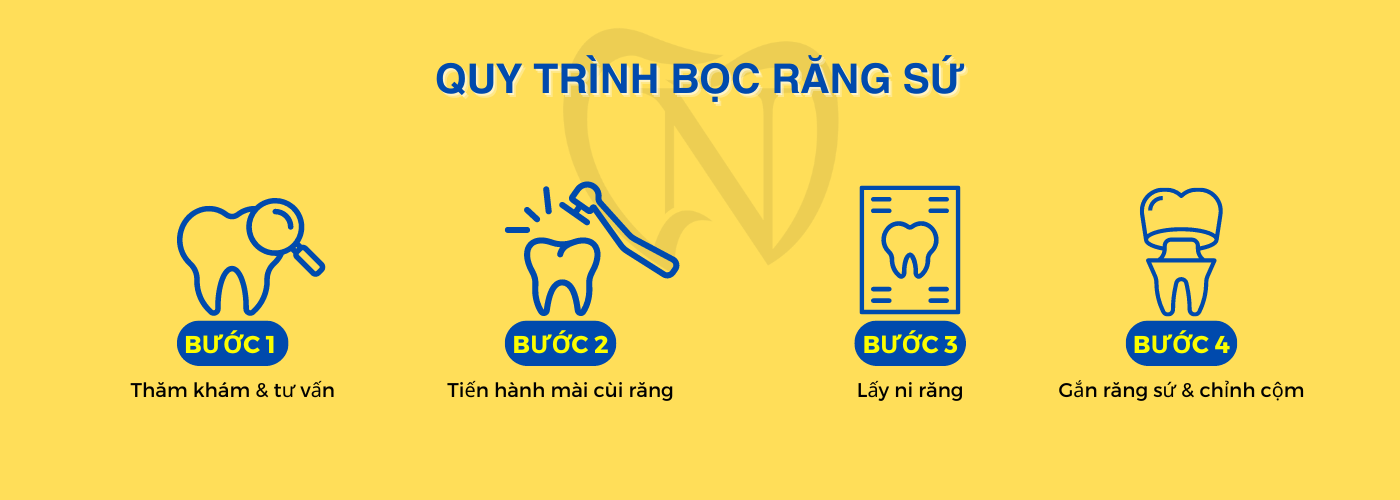 bọc răng sứ