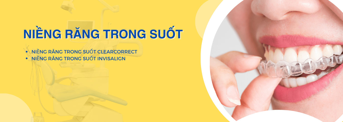 NIỀNG RĂNG TRONG SUỐT