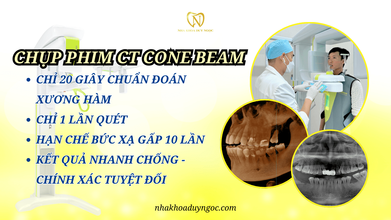 CHỤP PHIM CT CONE BEAM