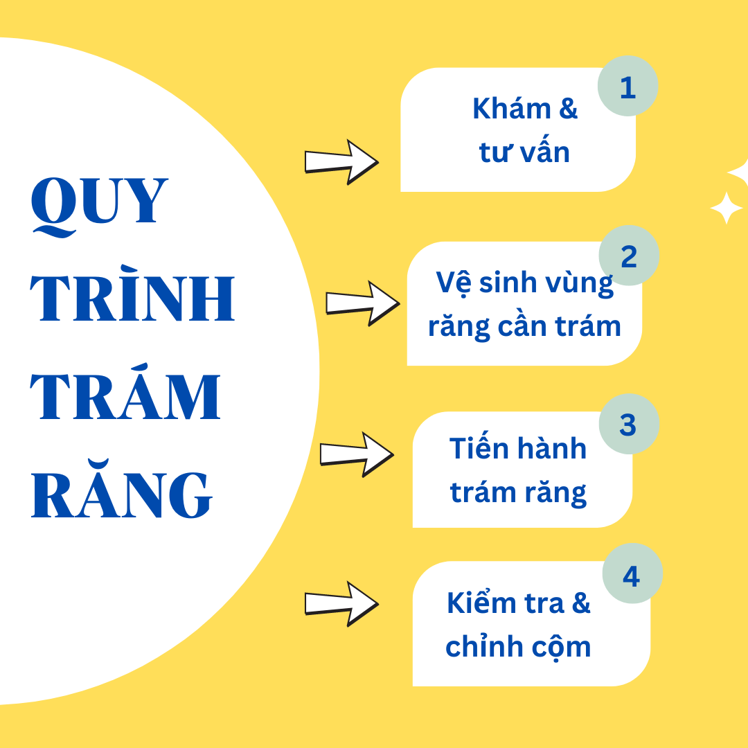 trám răng