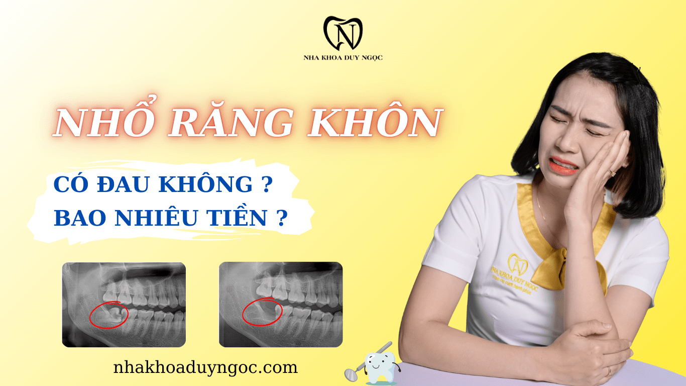 NHỔ RĂNG KHÔN