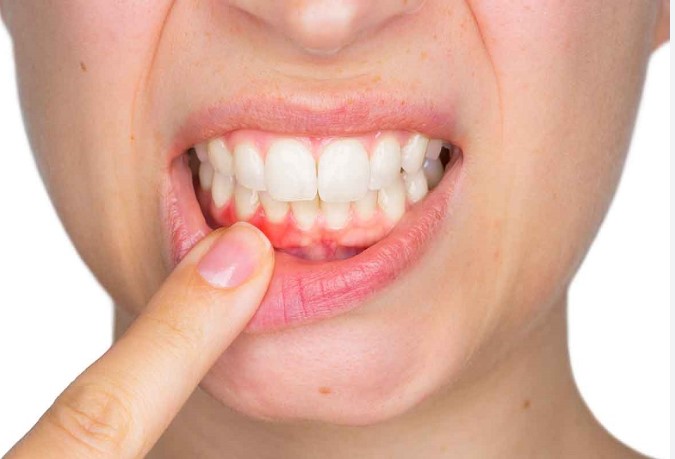 Chăm sóc răng miệng