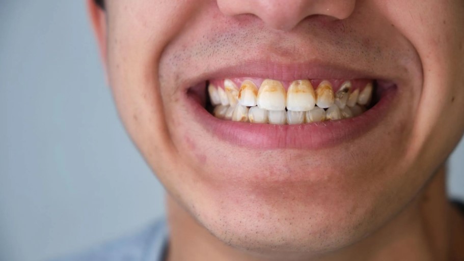 Chăm sóc răng miệng