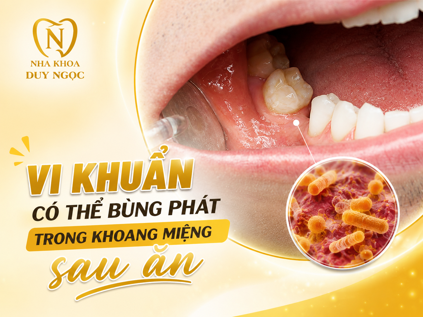 Chăm sóc răng miệng