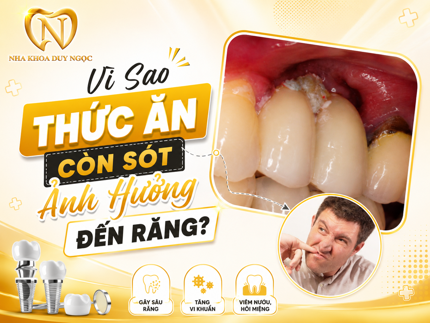 Chăm sóc răng miệng